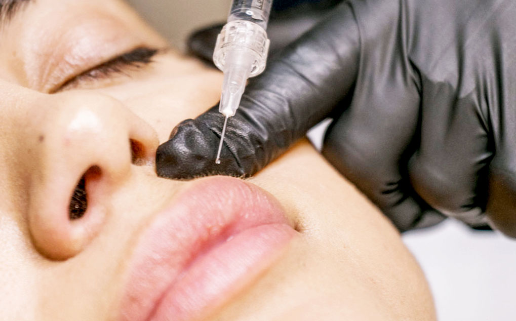 injection-course-in-lips