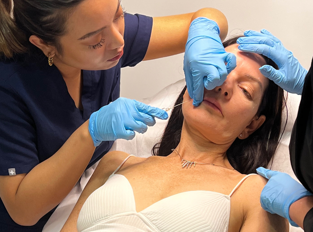 Lower Face Augmentation